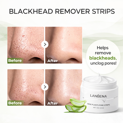 Lanbena Blackhead Remover Mask